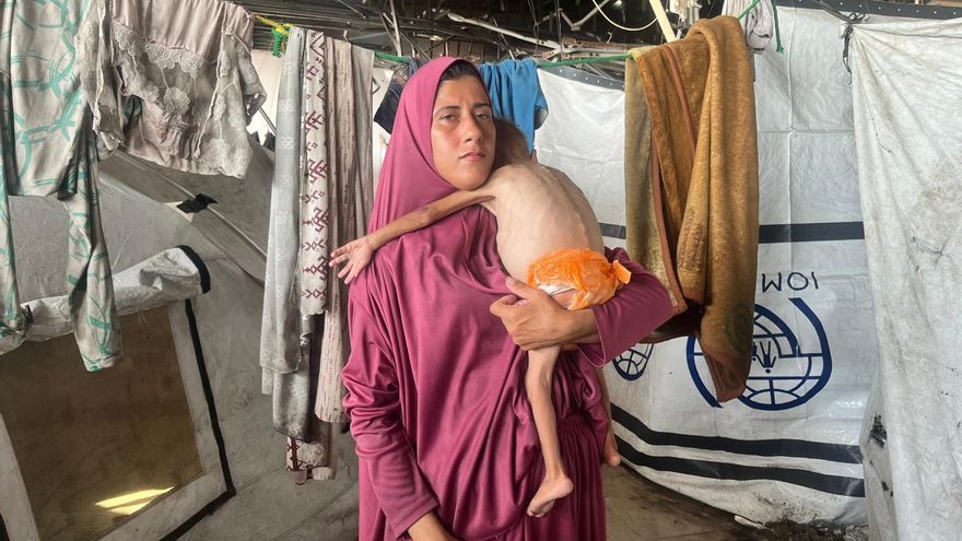 “Él no era así”: los bebés de Gaza transformados por la hambruna