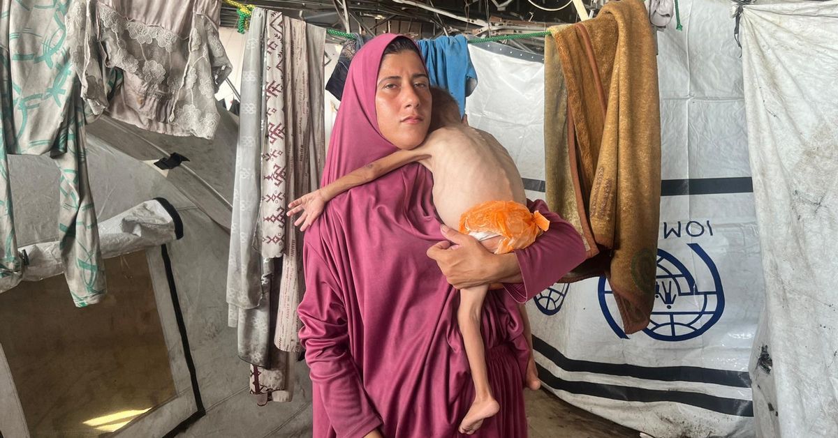 “Él no era así”: los bebés de Gaza transformados por la hambruna