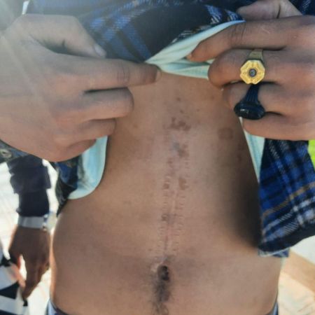 Ayoub muestra su cicatriz.