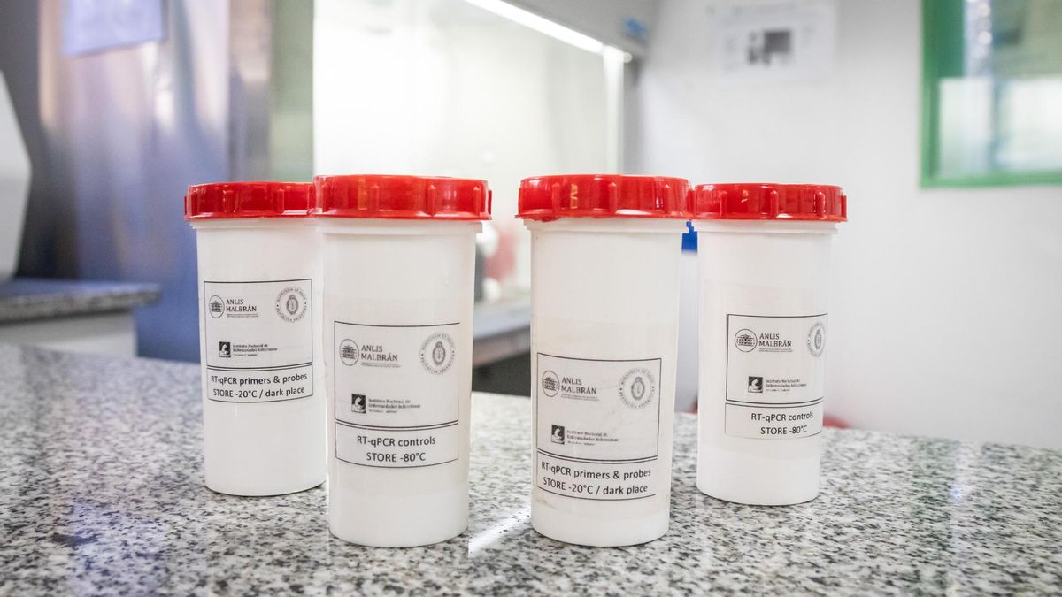 Argentina envía a países de África y Europa insumos para diagnosticar hantavirus