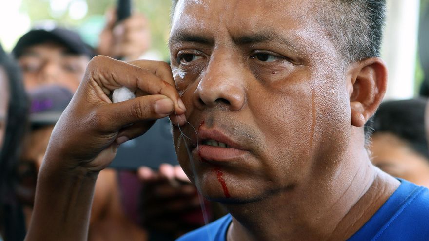Migrantes en caravana se suturan labios para presionar a Migración de México