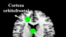 El cerebro de los votantes del PP experimenta una mayor repulsión hacia las noticias del PSOE que al revés, según un estudio