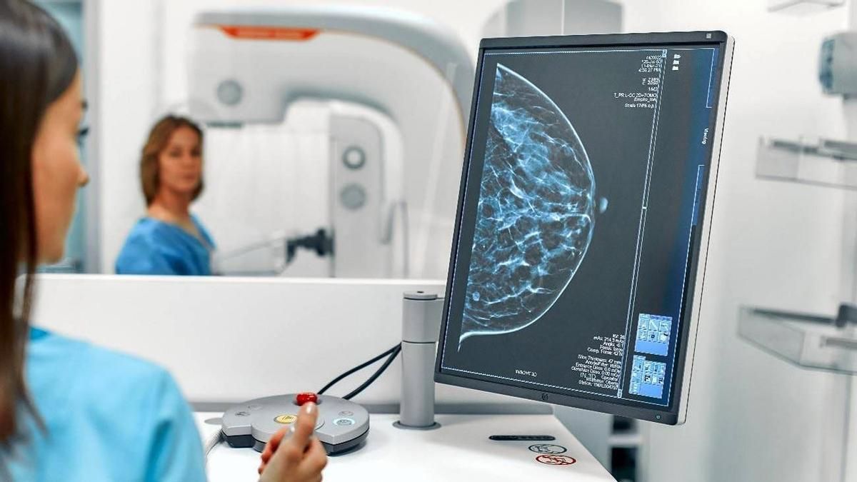 Un fármaco para suprimir la lactancia tras el parto, candidato para reducir el riesgo de cáncer de mama