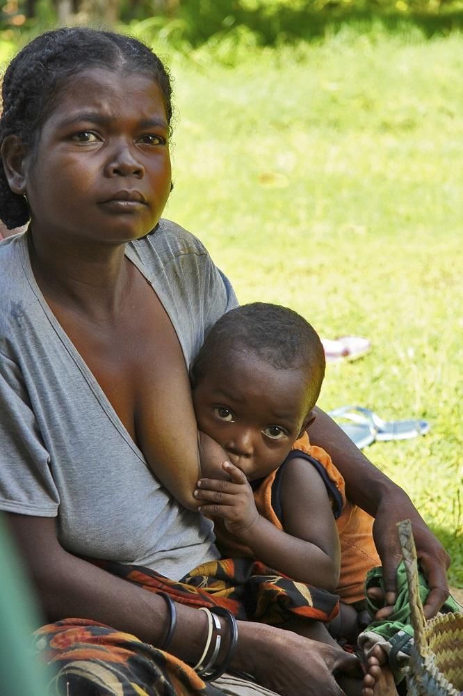 Región de Faragangana (Madagascar). - Madre tuberculosa con su hijo lactante. | MANOLO ARRABAL