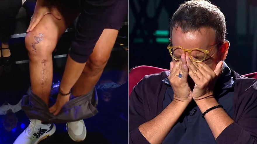 Àngel Llàcer mostró las secuelas de su enfermedad en su reaparición en TV: "Me dijeron que o salía sin pierna, o no salía"