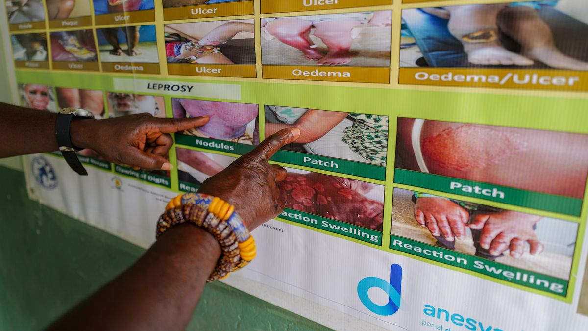 Una pancarta para sensibilizar sobre las enfermedades tropicales desatendidas en la oficina de la Fundación Gate en Ankarful, Región Central, Ghana.