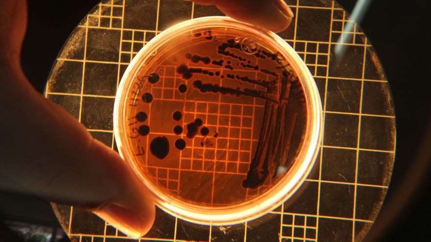 Qué es la 'E. coli', cómo afecta a la salud y por qué obliga a cerrar playas en Canarias