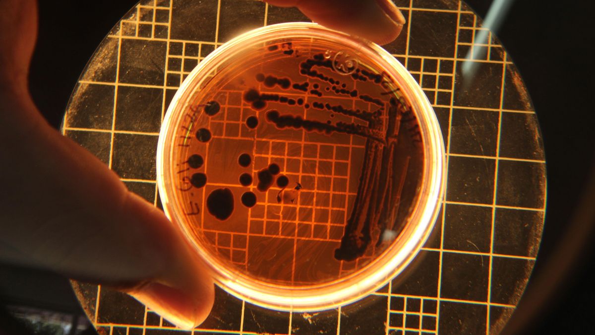 Qué es la 'E. coli', cómo afecta a la salud y por qué obliga a cerrar playas en Canarias