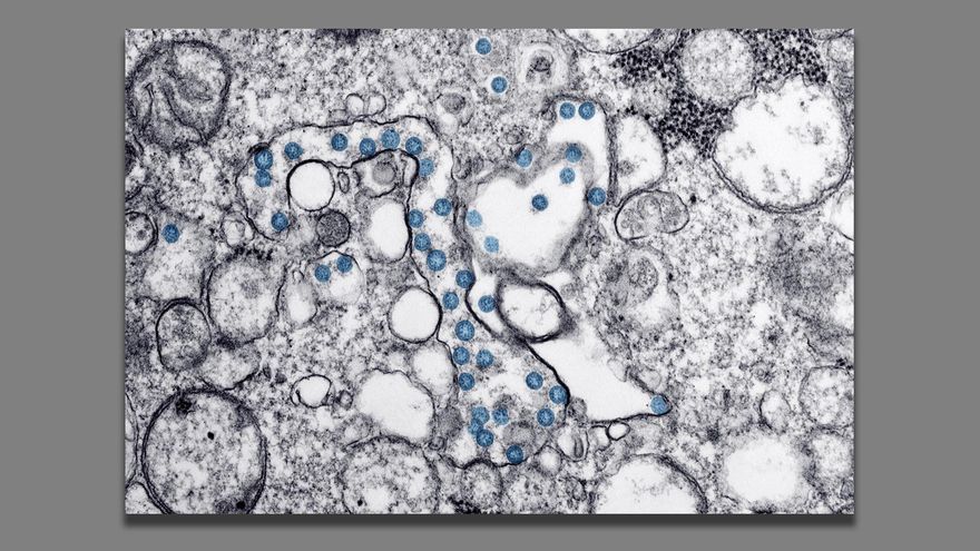 El coronavirus tiene capacidad de provocar un envejecimiento acelerado
