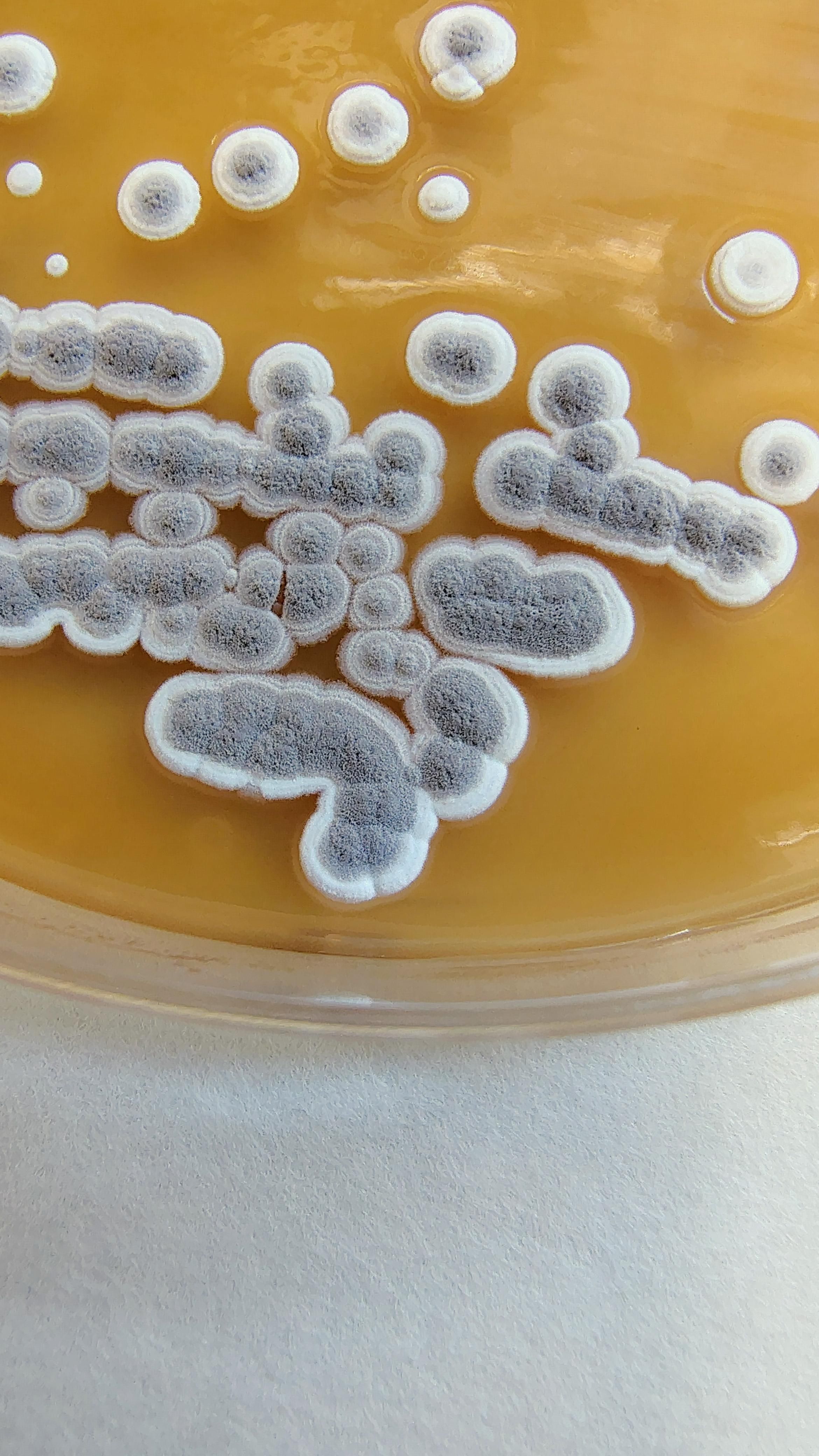 Imagen del crecimiento de las bacterias en una placa de cultivo