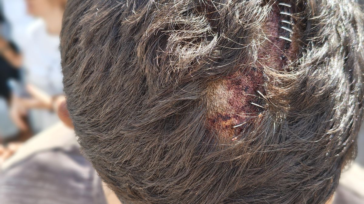 Defensa envía a la Justicia las denuncias de torturas y tratos degradantes de militares a migrantes en Ceuta