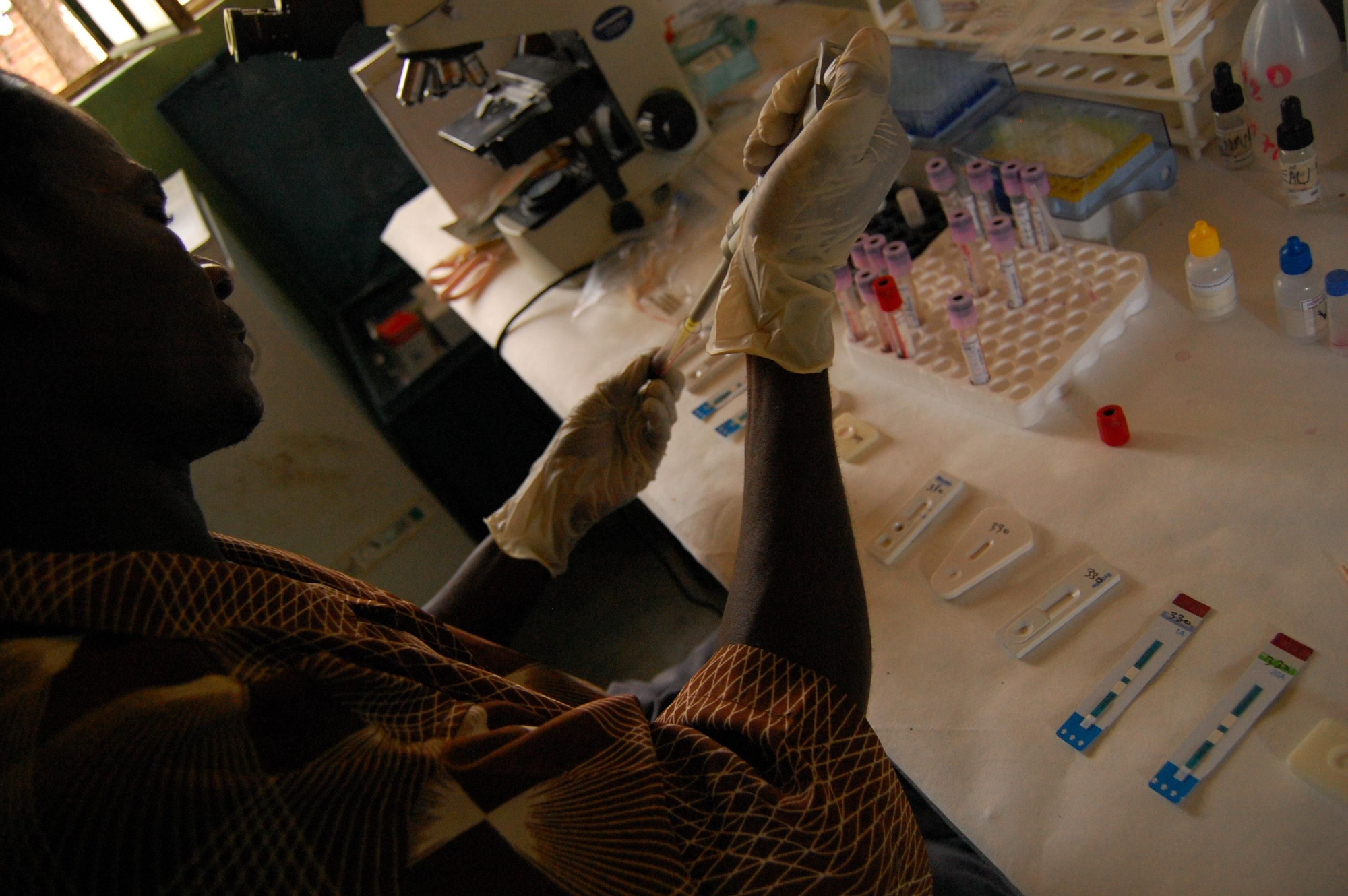 Cuando la malaria se convierte en severa, los pacientes sufren de anemia y requieren una transfusión de sangre. Un técnico de laboratorio de MSF realiza análisis de sangre para garantizar transfusiones seguras para tratar la anemia relacionada con la malaria. Kinkondja, provincia de Katanga, República Democrática del Congo. Fotografía: Sandra Smiley/MSF