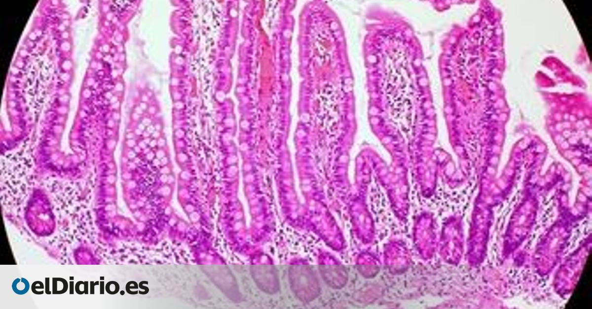 La flora intestinal es muy exigente con lo que come