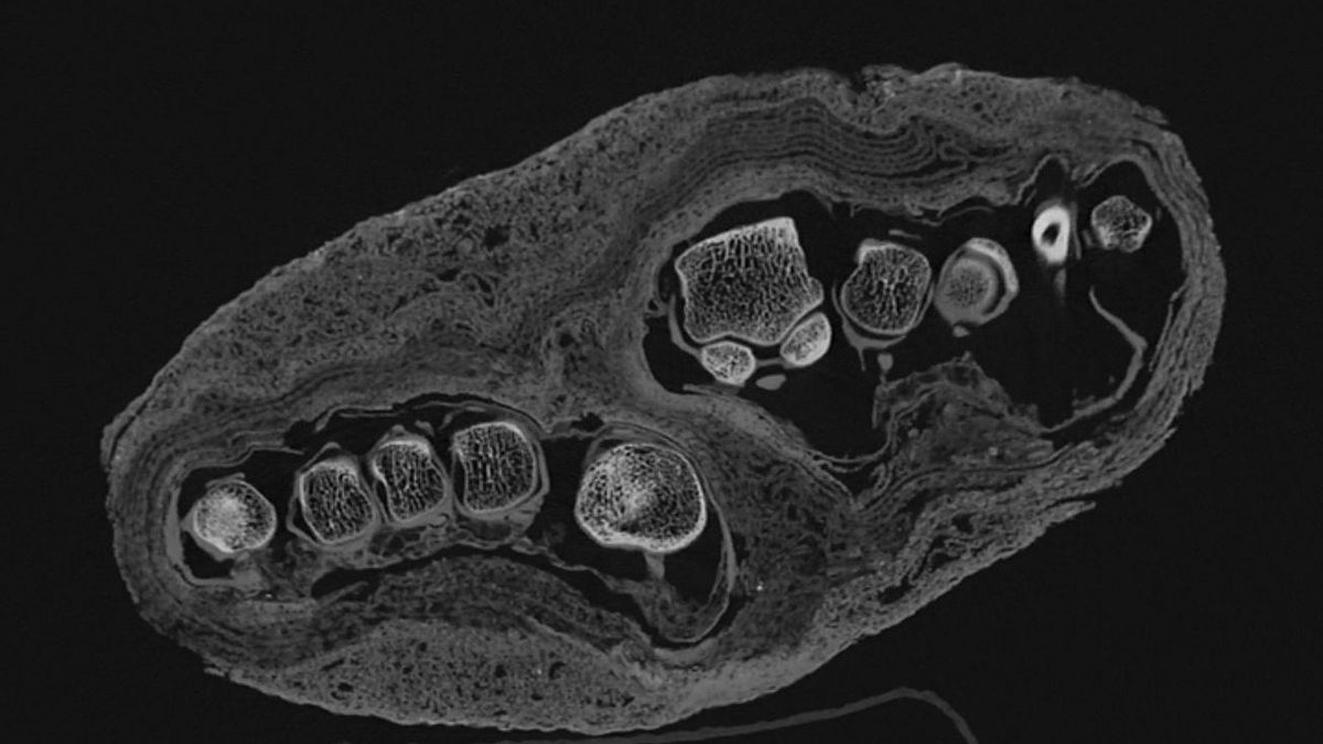 Análisis de huesos de las momias del antiguo Egipto.