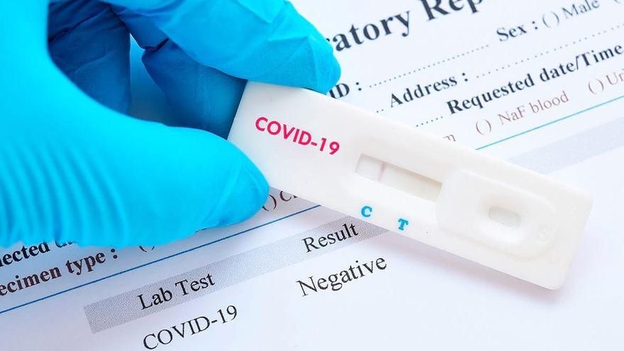 Canarias registra este jueves 196 casos de Covid-19 en las últimas 24 horas