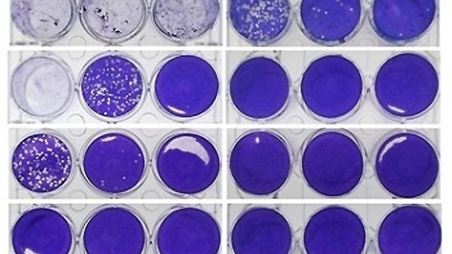 Cultivos de coronavirus expuestos a luz ultravioleta. // Departamento de Óptica UCM