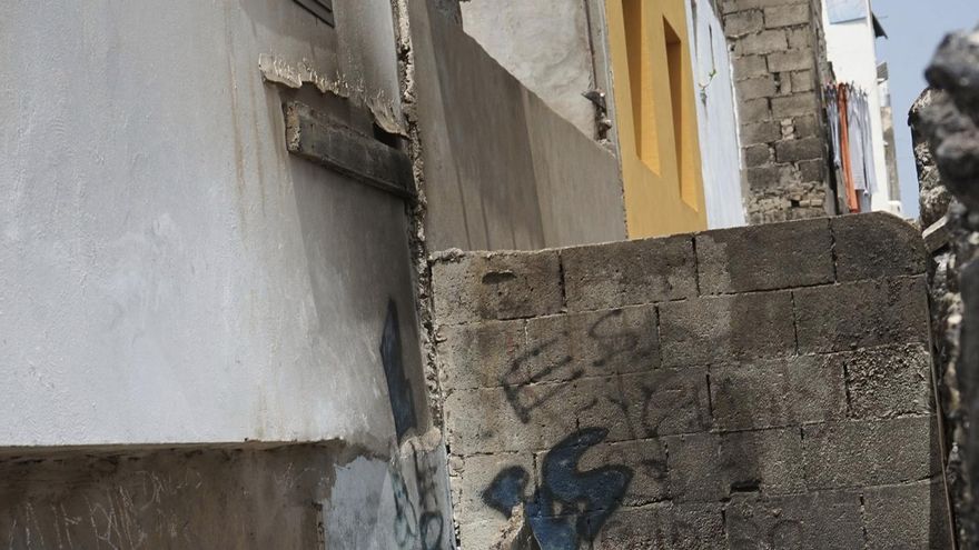 El Juzgado de Violencia contra la Infancia y la Adolescencia de Las Palmas asume la causa de la joven quemada