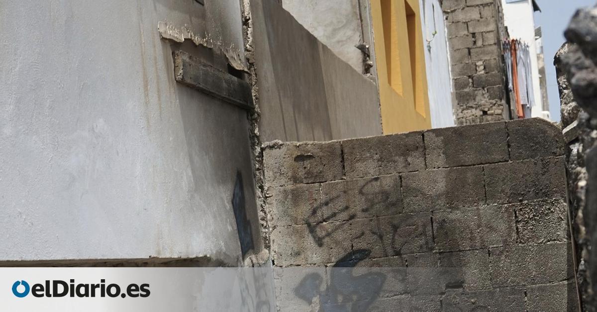 El Juzgado de Violencia contra la Infancia y la Adolescencia de Las Palmas asume la causa de la joven quemada