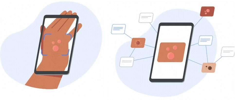 Diagramas de DermAssist, la Inteligencia Artificial que hace diagnósticos de dermatología de Google