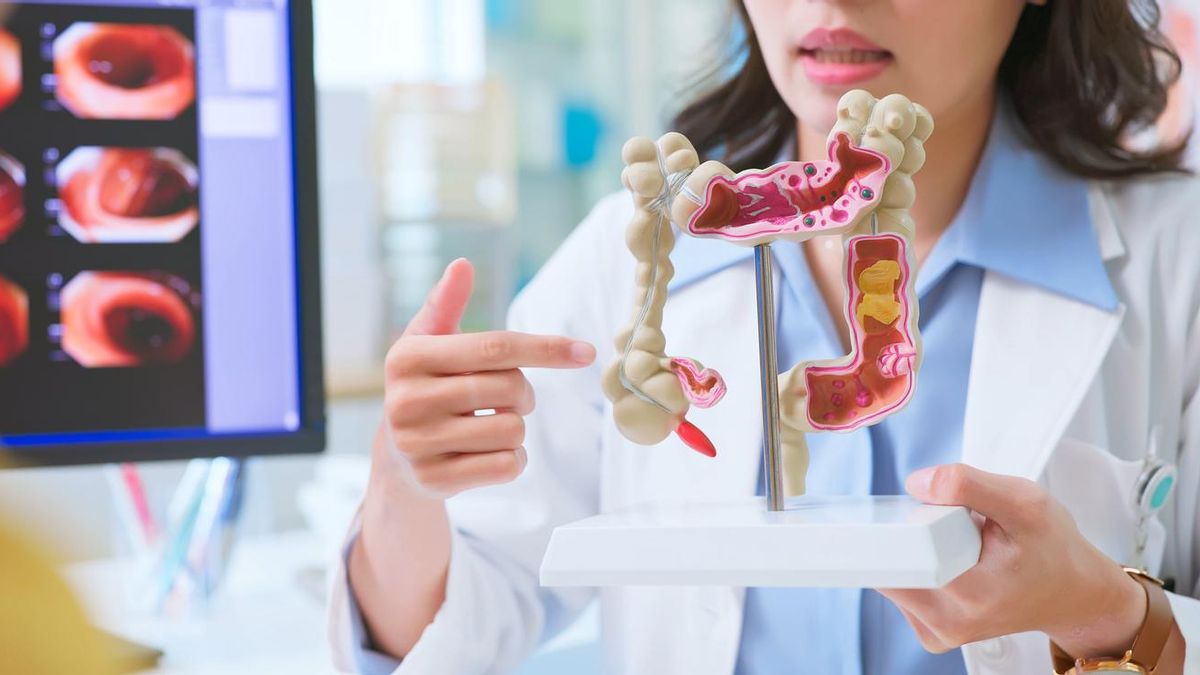 Cómo reconocer los síntomas del cáncer de colon, que empieza de forma silenciosa