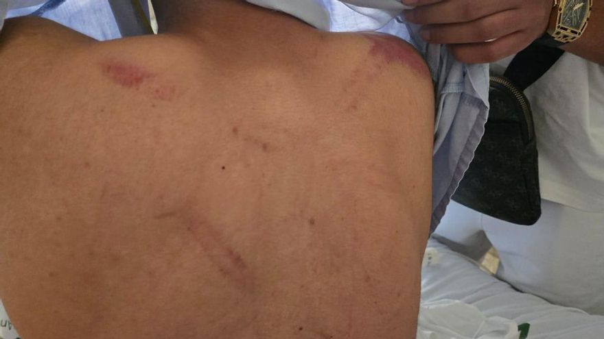 El detenido en Las Tendillas presenta una denuncia contra la Policía por una presunta agresión