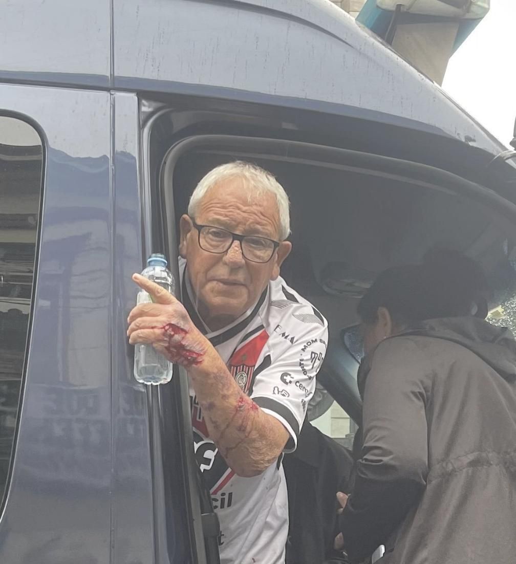 Carlos "Chaca" Dawlowfki brutalmente herido y detenido el miércoles pasado durante la manifestación de jubilados.