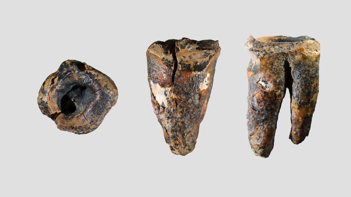 ¿Un dentista neandertal? El orificio en una muela sugiere el primer ‘tratamiento dental’ hace 60.000 años