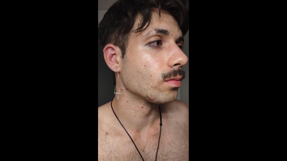 Golpeado al grito de "maricón": denuncian una agresión homófoba en las fiestas de Cartagena