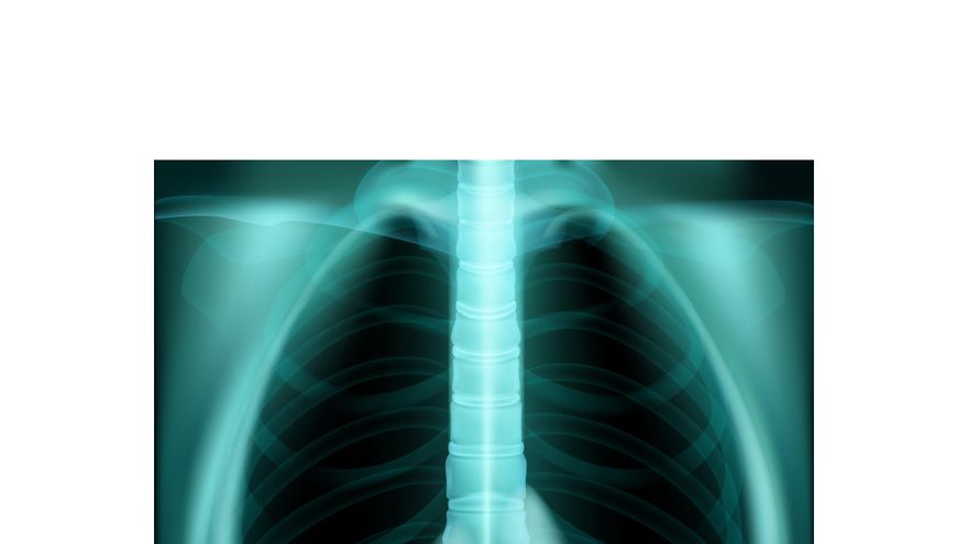 Las presiones públicas para implantar cribados de cáncer a veces ignoran las evidencias científicas