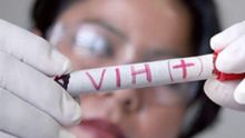 La resistencia del VIH a los fármacos empieza a ser preocupante según la OMS