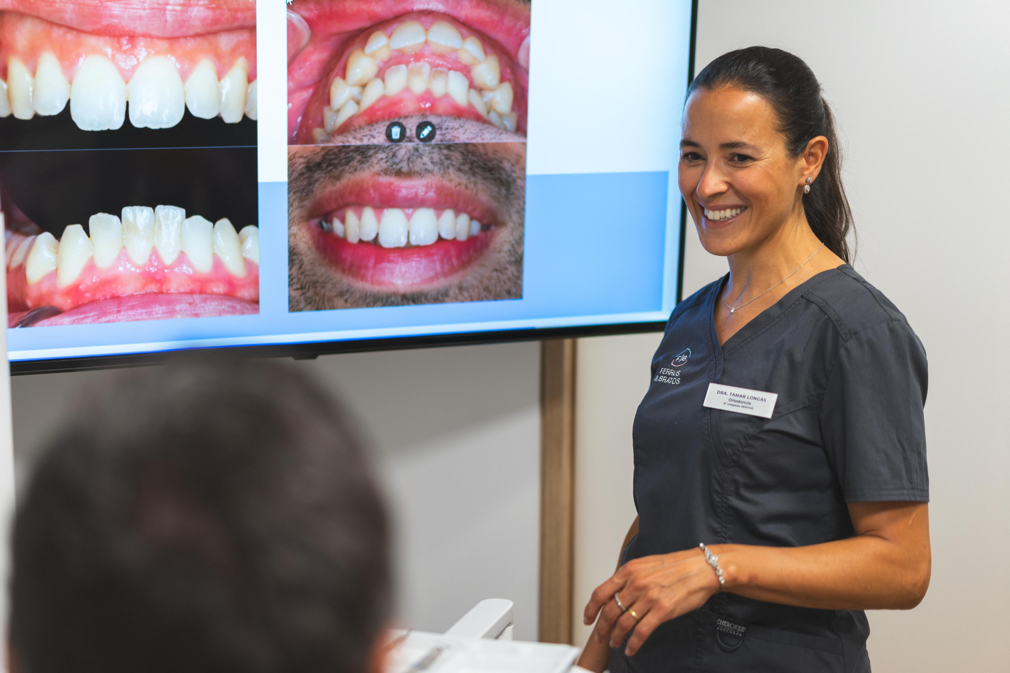 Proceso de ortodoncia en Clínica Ferrus & Bratos