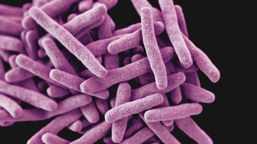 Las muertes por tuberculosis aumentan por primera vez en más de una década por la COVID