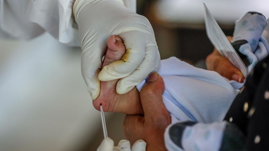 Solo seis comunidades practican el cribado neonatal de la atrofia muscular espinal