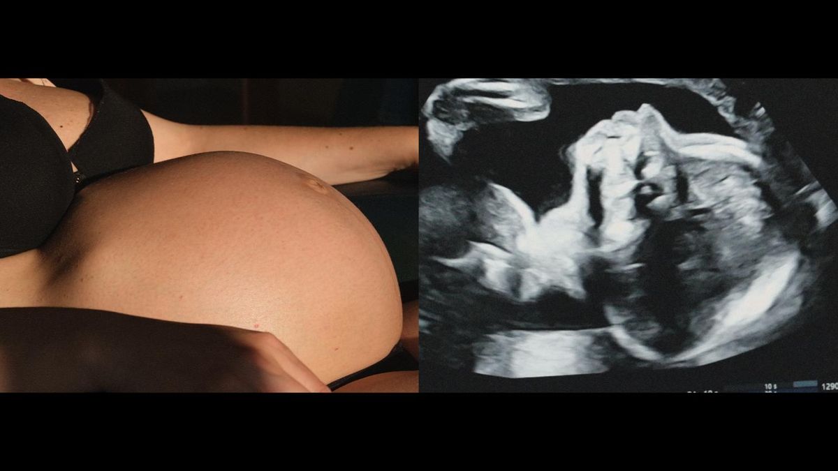 Imagen del documental 'Un arbre es un arbre'