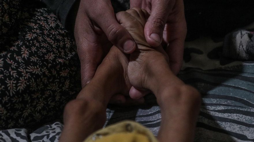 Los muertos por desnutrición en Gaza superan ya los 250, incluidos 11 este viernes