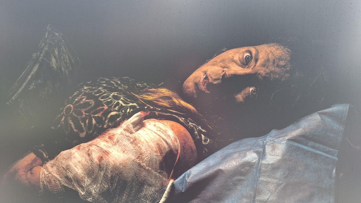 La mirada de una mujer herida en la ciudad ucraniana de Jersón, fotografiada por Bernat Armangué