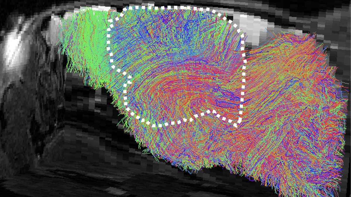 Mapa de las vías estimadas de fibras nerviosas en el cerebro de un ratón xenocortical.