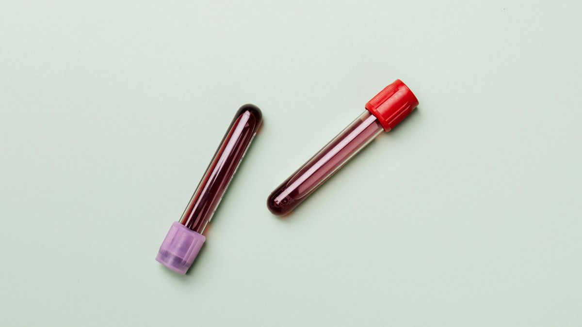 Un análisis de sangre combinado con inteligencia artificial crea un 'reloj metabólico' para detectar envejecimiento y enfermedades