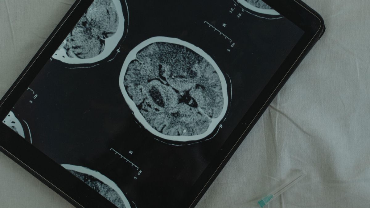 Dos poblaciones celulares forman regiones cerebrales diferentes