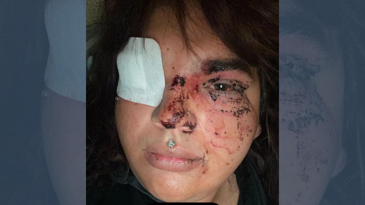 Una mujer trans denuncia una brutal paliza a manos de un grupo de personas en La Bañeza este fin de semana