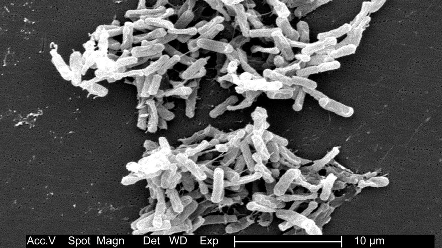 Alertan de la rápida propagación por todo el mundo de un gen que hace a las bacterias resistentes a los antibióticos
