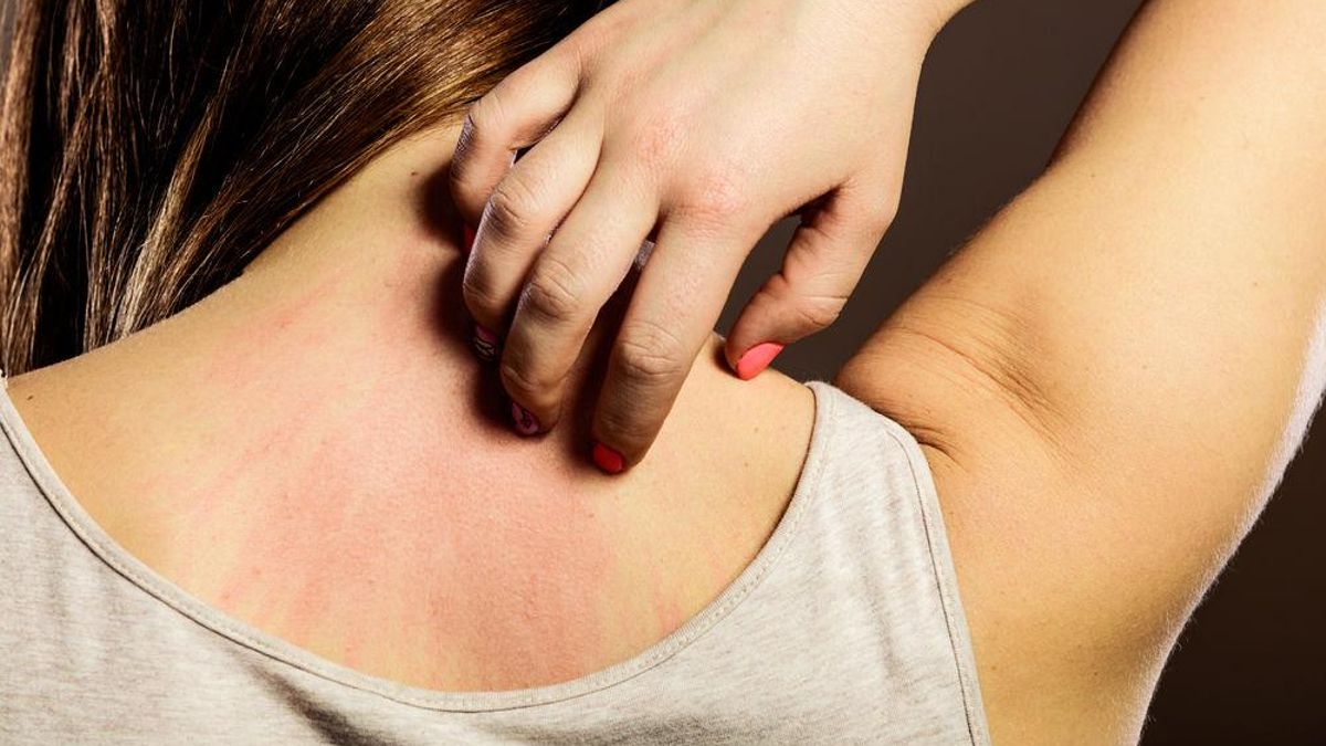 Día Mundial de la Alergia: ¿por qué se conmemora el 8 de julio?