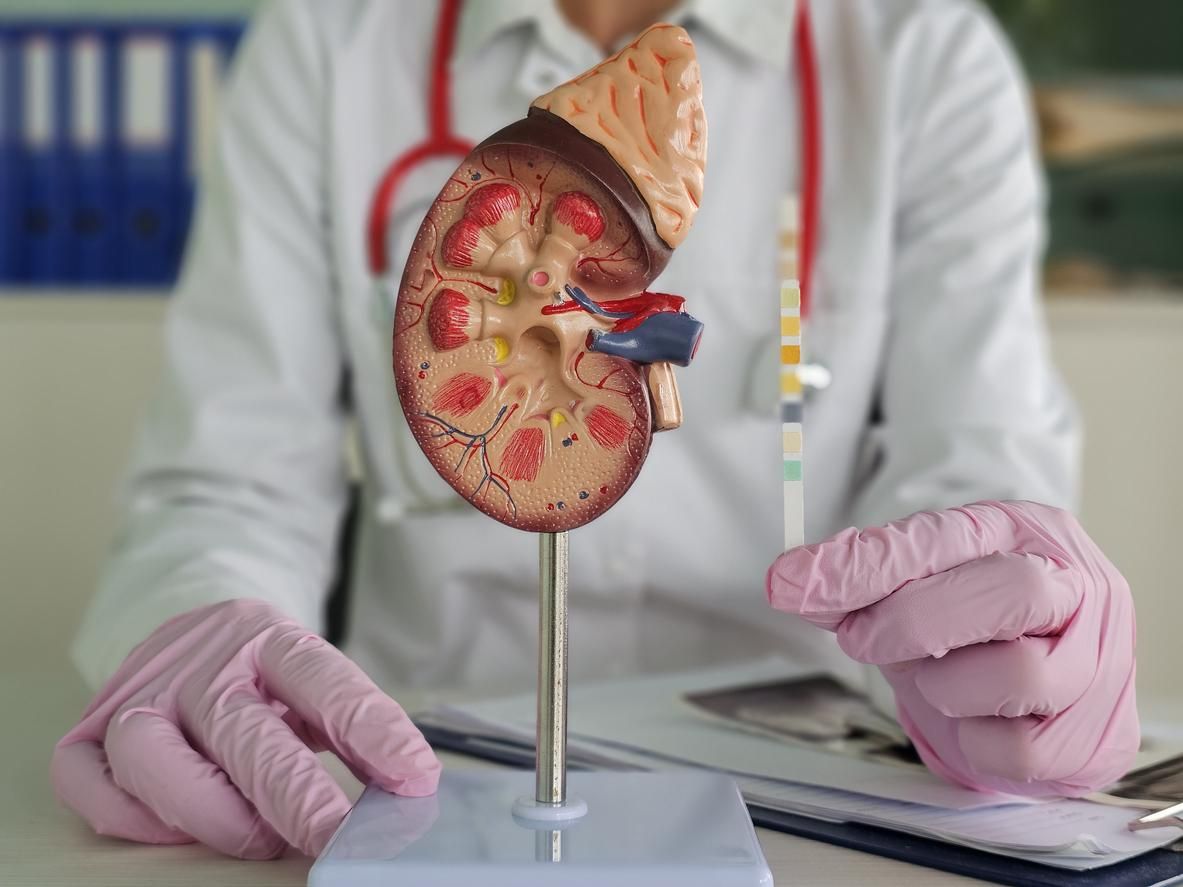 Modelo anatómico de un riñón