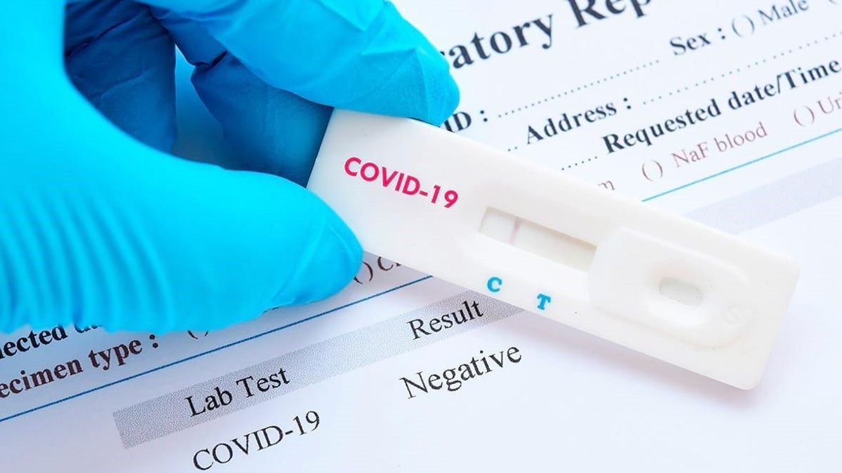 Test COVID-19