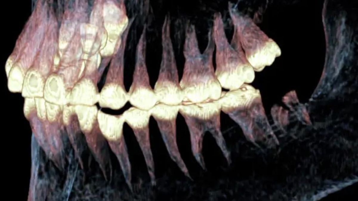 Las imágenes médicas mostraron un impacto devastador y una reparación sorprendente para su época