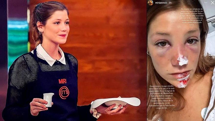 Miri Pérez, de 'MasterChef', sufre un accidente de moto: "Se me han comido y se han dado a la fuga"