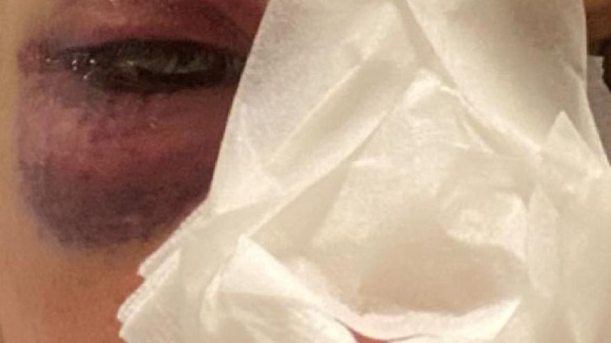 Tres mujeres denuncian una presunta agresión policial en Granada mientras intentaban parar un desahucio