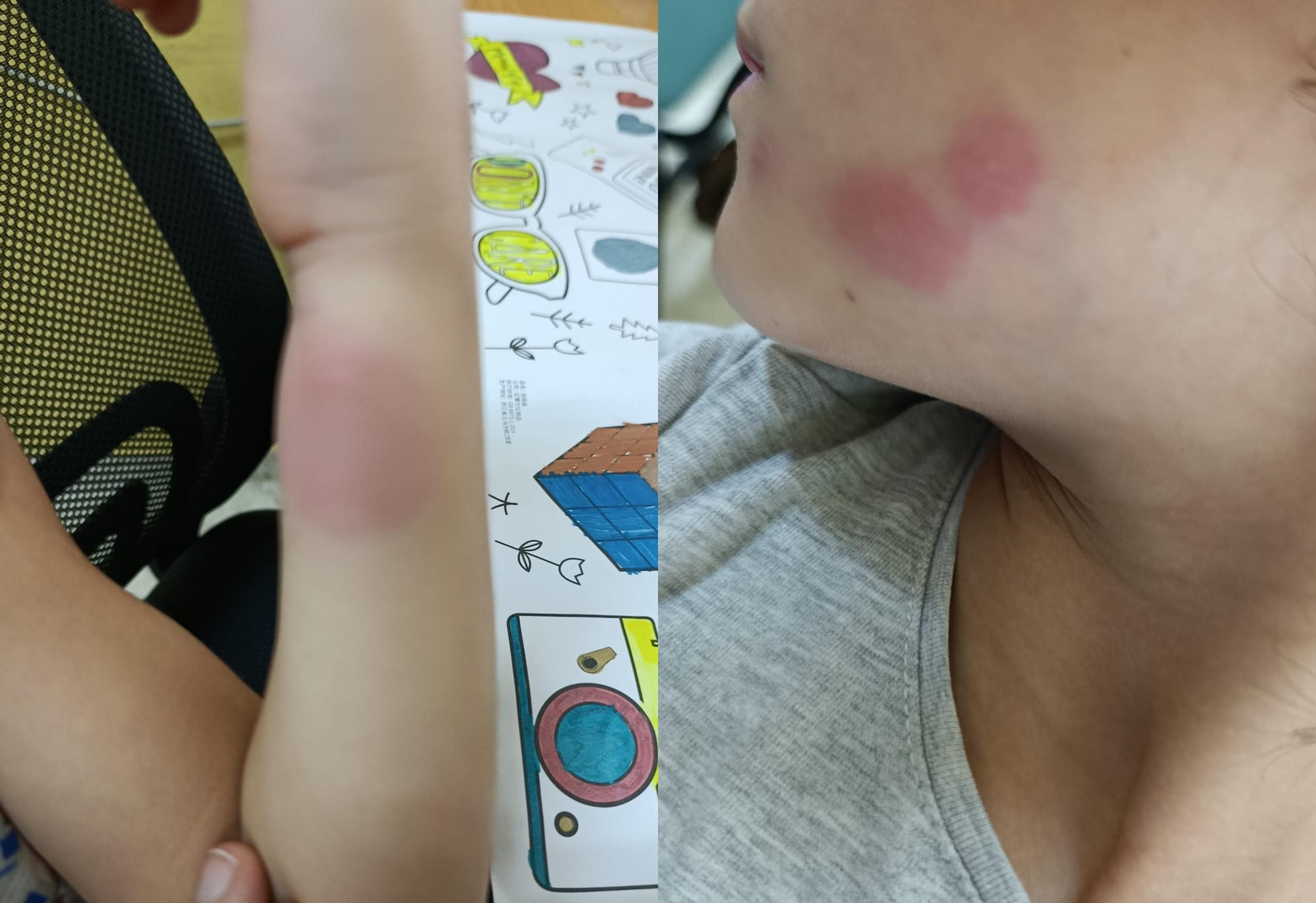 Las familias denuncian que la falta de limpieza propicia que habiten insectos en los inmediaciones del centro