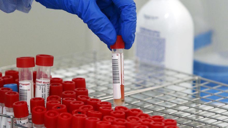 Tubos de pruebas PCR para la detección del COVID-19 en el "Autocovid" del Hospital Universitario Central de Asturias (HUCA), Oviedo (Asturias), a 11 de noviembre de 2020. Asturias continúa teniendo una de las tasas de incidencias de coronavirus más altas