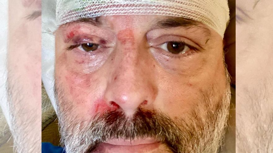 Juan, meses esperando una prueba que explique sus desmayos: "Estaría muerto si no pudiera pagarme la sanidad privada"